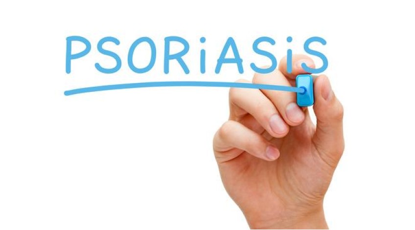 ΑΝΤΙΜΕΤΩΠΙΣΤΕ ΤΗΝ ΨΩΡΙΑΣΗ ΜΕ ΦΥΣΙΚΕΣ ΜΕΘΟΔΟΥΣ!