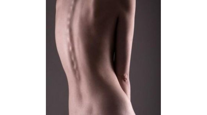 ΔΙΑΤΡΟΦΗ ΓΙΑ ΕΛΛΙΠΟΒΑΡΗ ΑΤΟΜΑ - ΑΥΞΗΣΗ ΒΑΡΟΥΣ