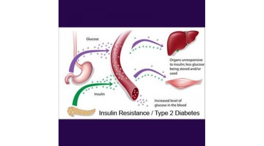 ΑΝΤΙΣΤΑΣΗ ΣΤΗΝ ΙΝΣΟΥΛΙΝΗ
