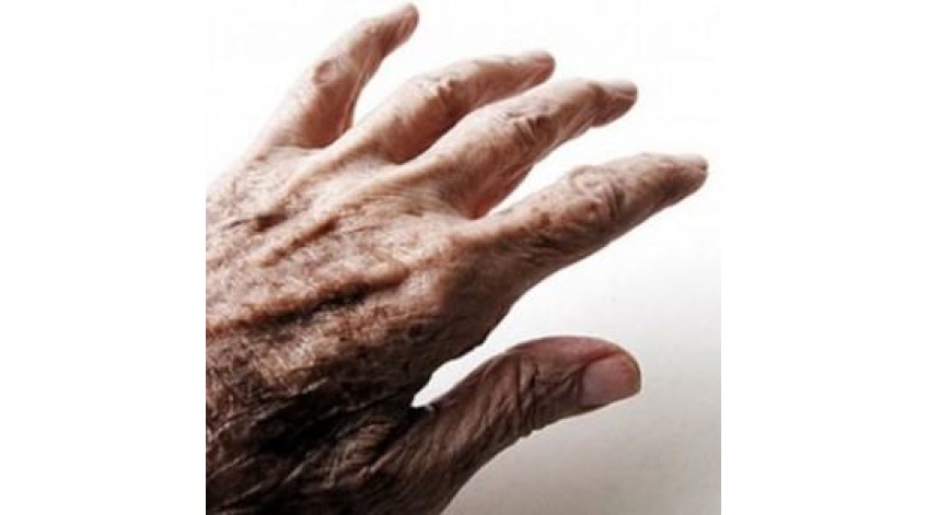 ΣΥΣΤΗΜΑ ΔΙΑΤΡΟΦΗΣ ΓΙΑ ΤΑ ΑΤΟΜΑ ΜΕ ΝΟΣΟ ΠΑΡΚΙΝΣΟΝ