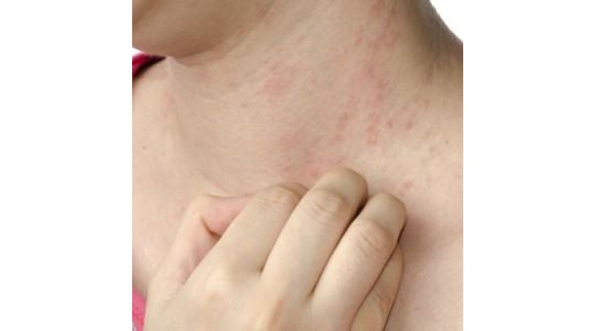 ΨΩΡΙΑΣΗ - ΕΚΖΕΜΑ