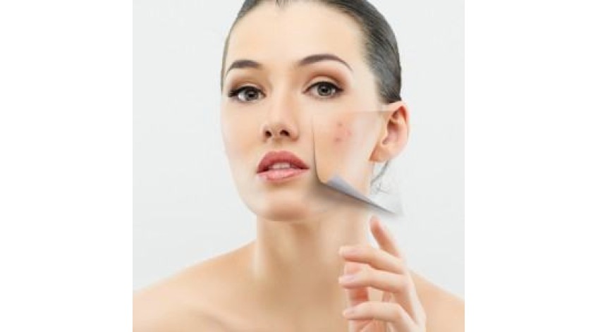 ΡΟΔΟΧΡΟΥΣ ΝΟΣΟΣ